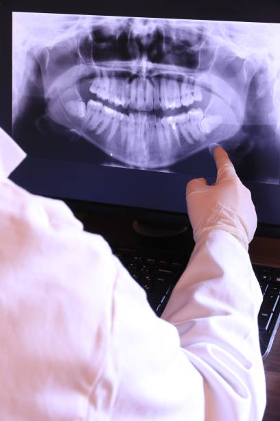 Best Emergency Denture Repair in Spring Lake Heights, NJ